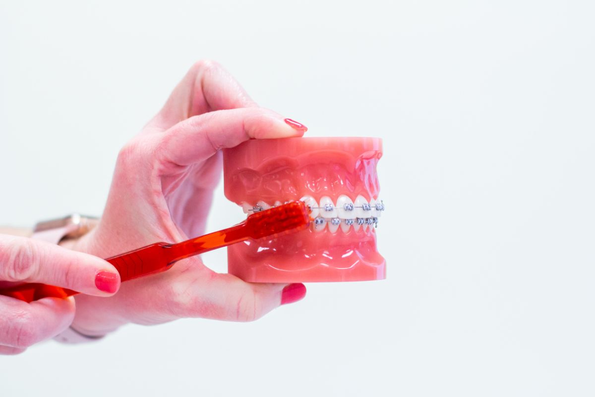 Tips for Brushing Your Teeth With Braces